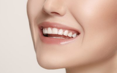 What are The Different Types of Cosmetic Dentistry?