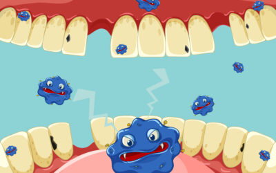 Combatting Periodontal Gum Disease in Toronto: Expert Care at Bathurst Western Dental